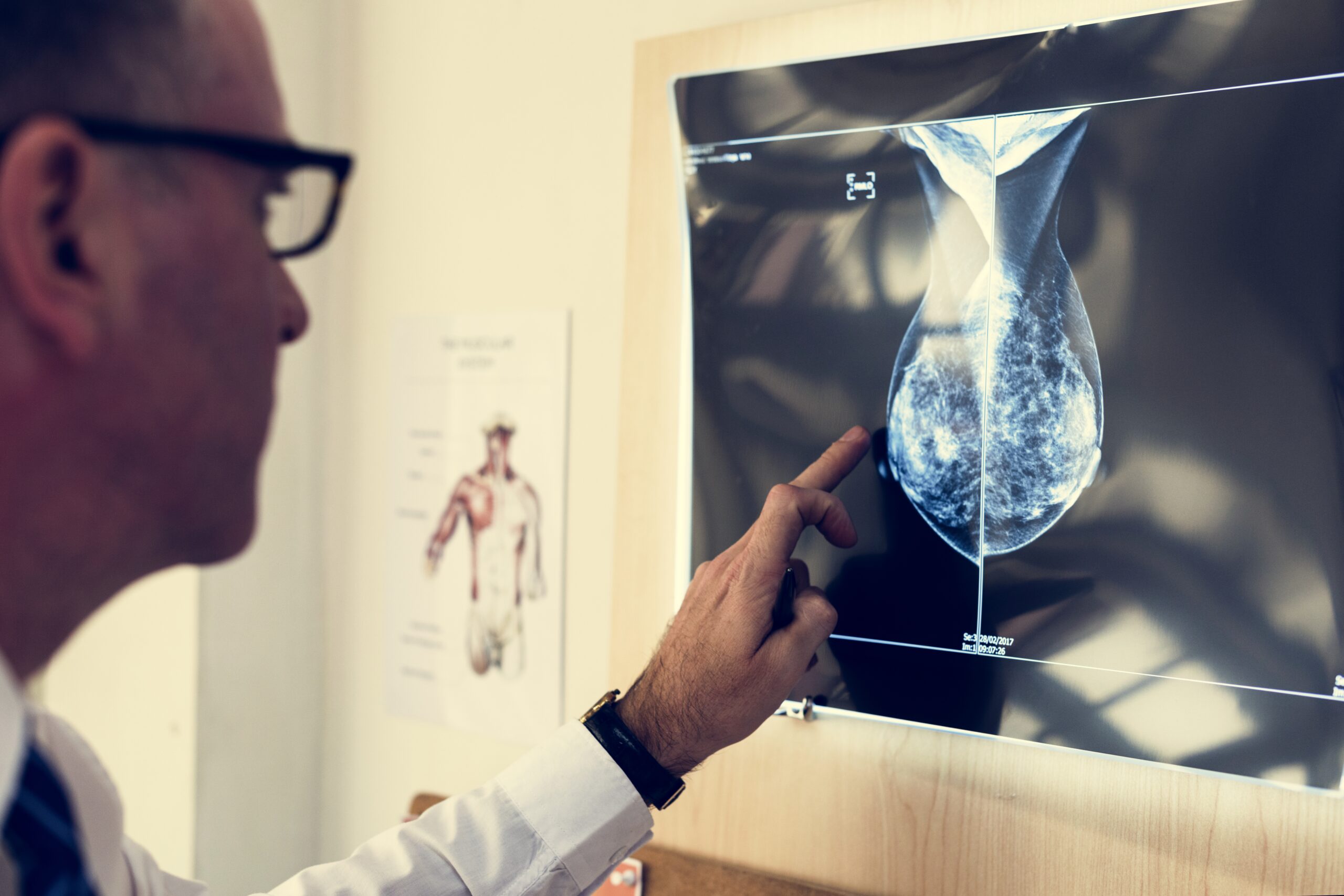 Doctor is checking patient x-ray film